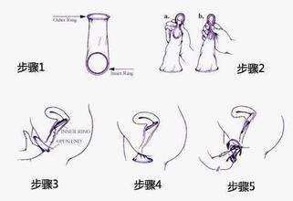 垃圾桶里的这半盒避孕套，可能是一次误会——或者是危机